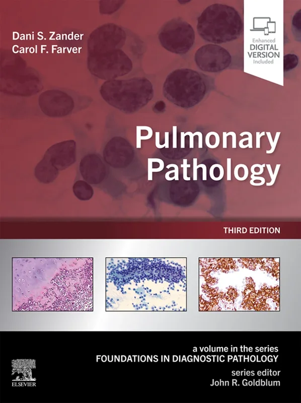 Pulmonary Pathology 3rd Edition