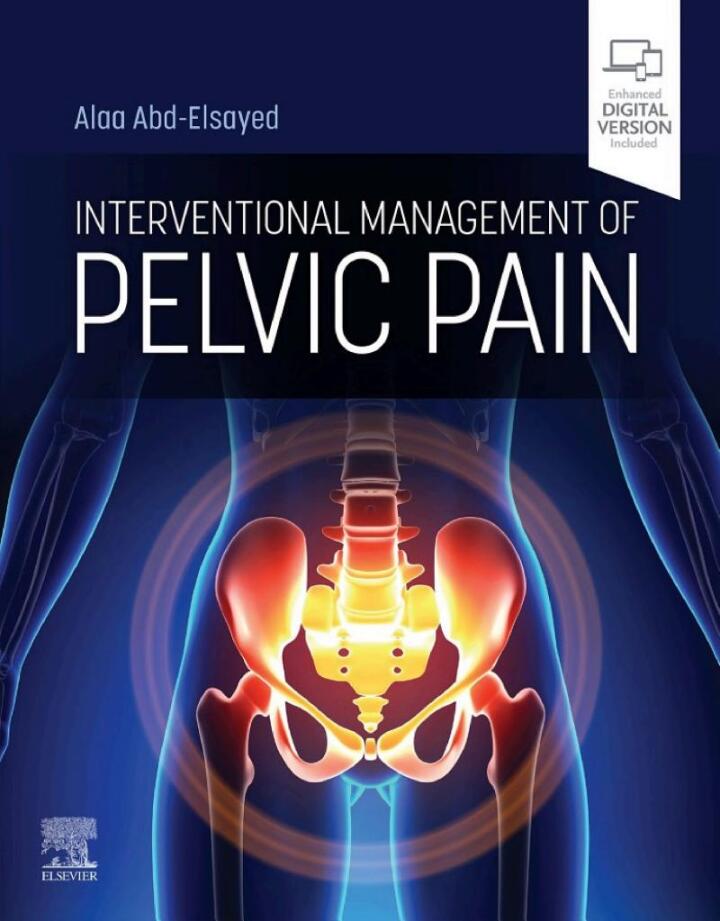 Interventional Management of Pelvic Pain