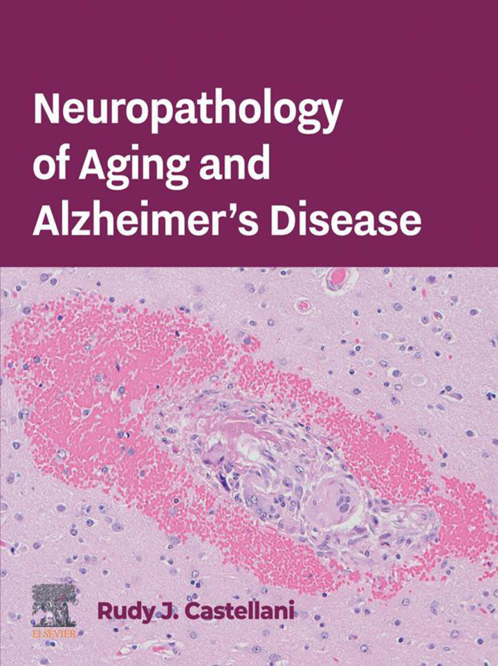 Neuropathology of Aging and Alzheimer's Disease